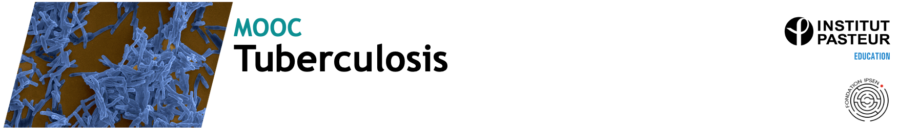 Head_Tuberculosis